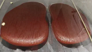 Preview at 00:05