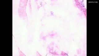 Preview at 00:24
