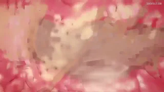 Preview at 00:14