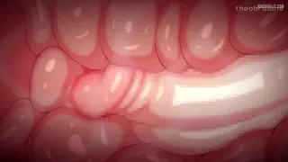 Preview at 00:01