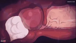 Preview at 00:10