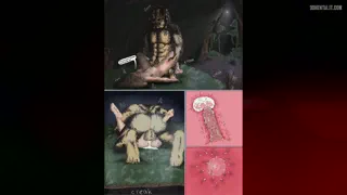 Preview at 00:03